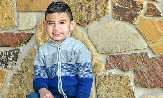 Thumbnail for A newborn's timely diagnosis results in life-changing craniofacial surgery