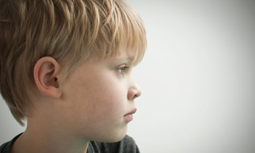 Thumbnail for Absence seizures in children