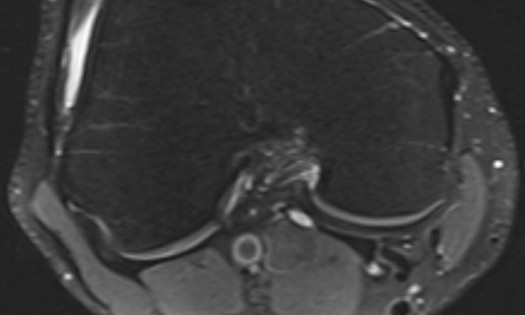 Thumbnail for Research Library