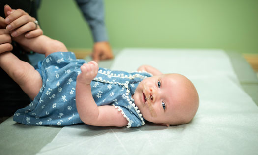 Thumbnail for About cleft lip and palate in children