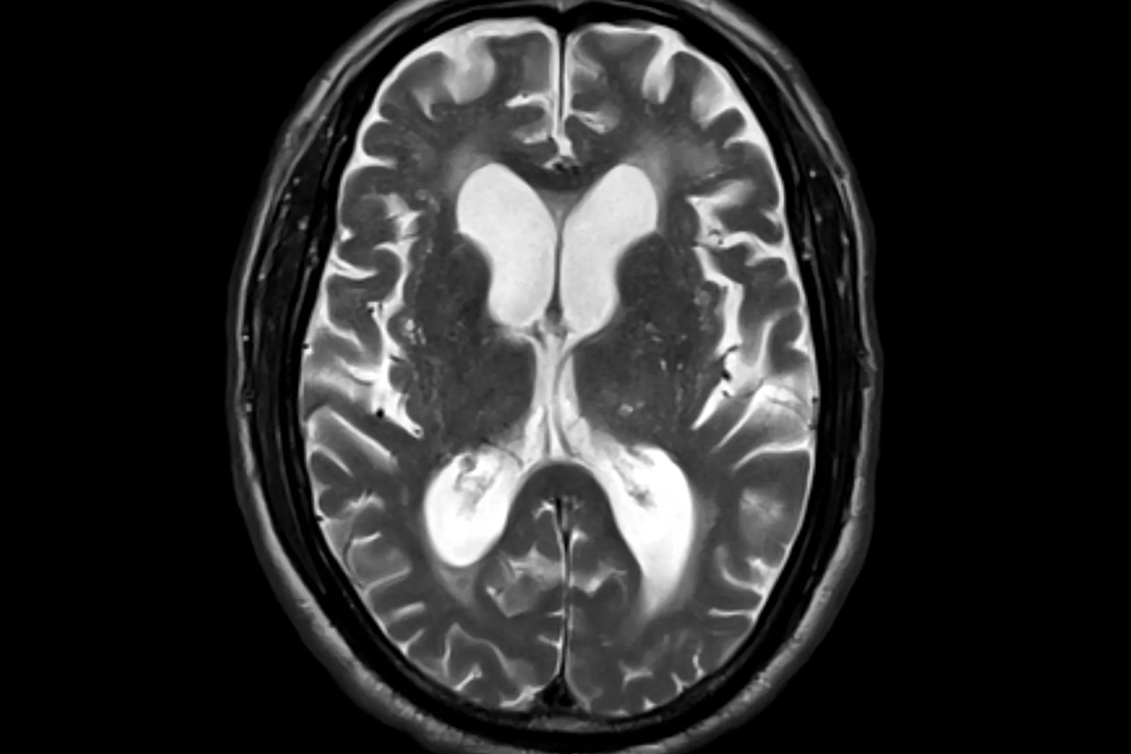Thumbnail for Research Library