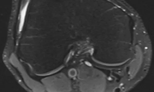 Thumbnail for Research Library